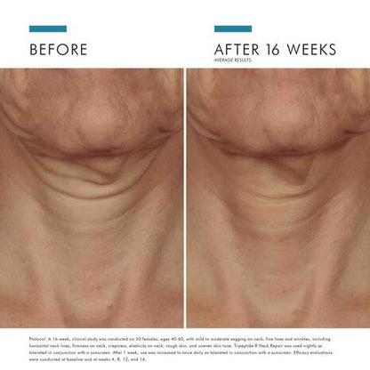 SkinCeuticals Tripeptide-R Neck Repair